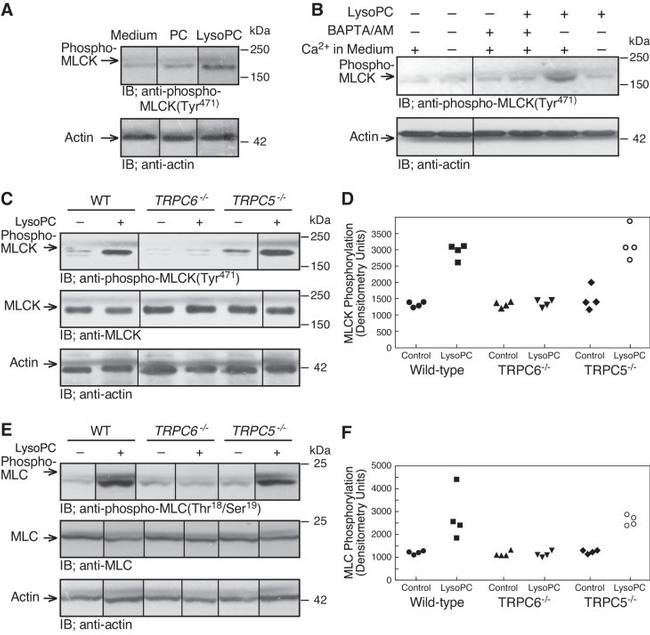 Actin Antibody in Western Blot (WB)