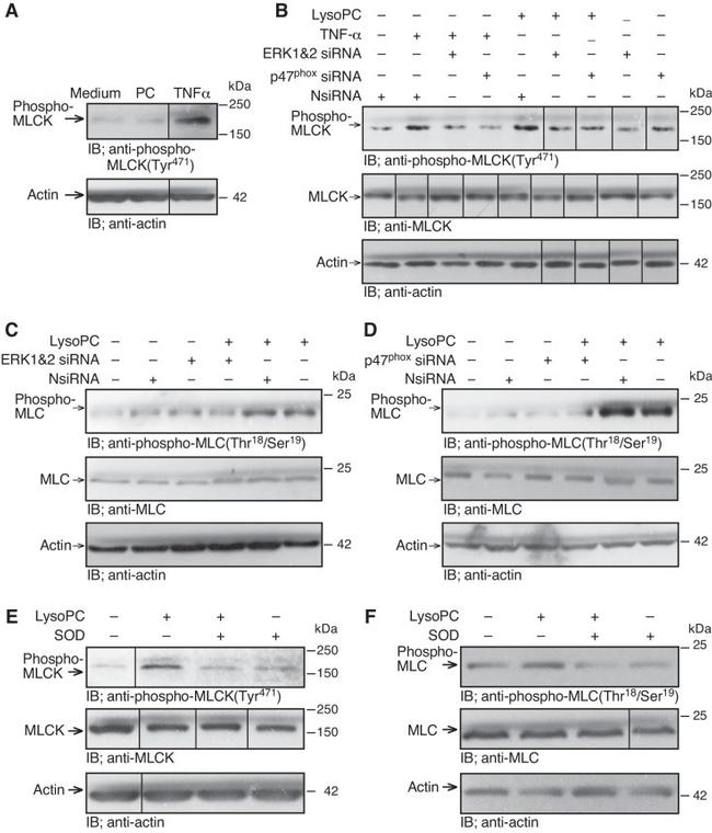 Actin Antibody in Western Blot (WB)