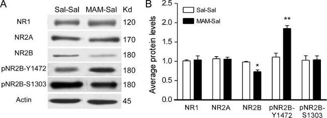 NMDAR1 Antibody in Western Blot (WB)