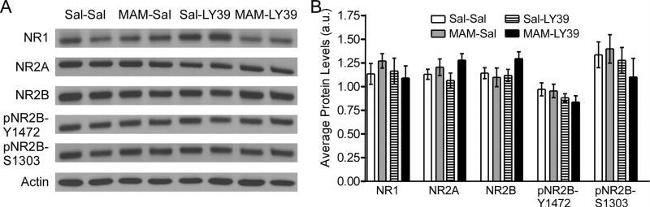 NMDAR1 Antibody in Western Blot (WB)