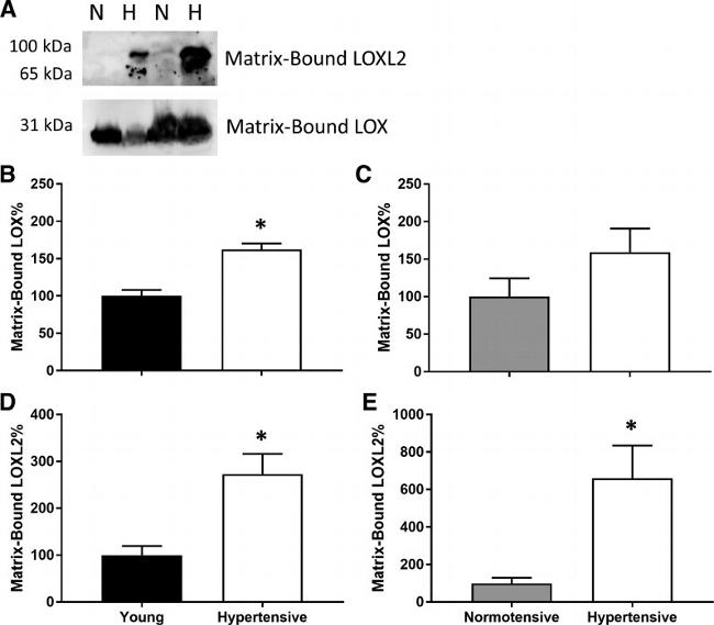 LOX Antibody in Western Blot (WB)