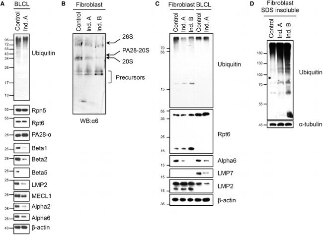 PSMB10 Antibody in Western Blot (WB)