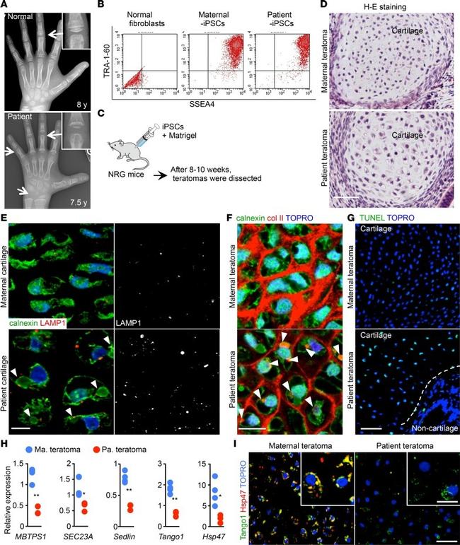 Collagen II Antibody in Immunohistochemistry (IHC)