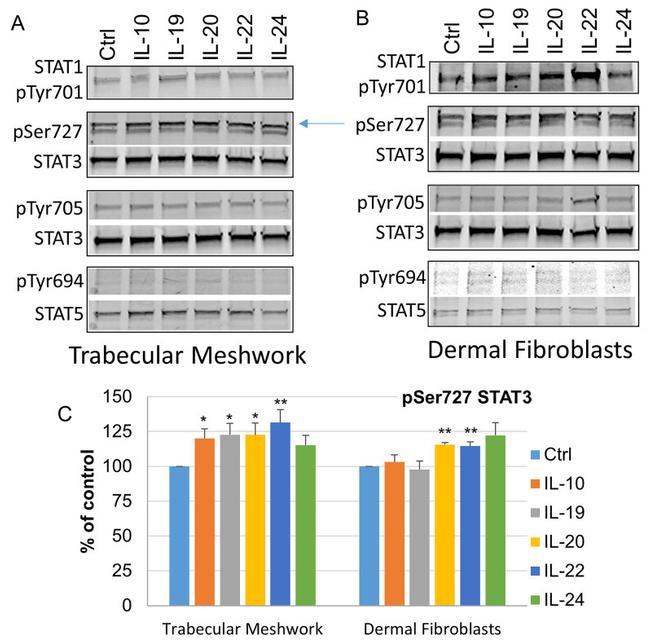 Phospho-STAT1 (Tyr701) Antibody in Western Blot (WB)