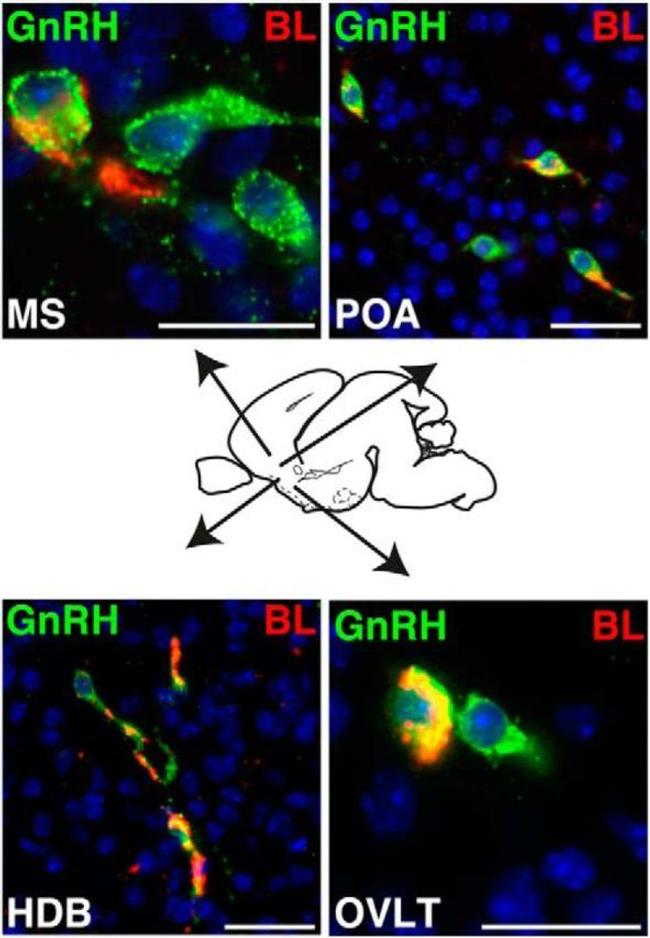 GnRH1 Antibody in Immunohistochemistry (IHC)