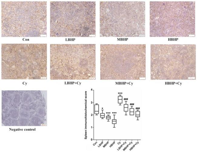 SOCS1 Antibody in Immunohistochemistry (IHC)