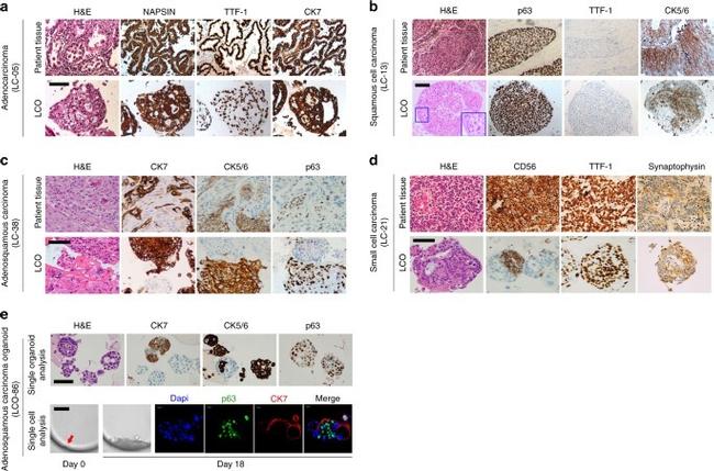 Cytokeratin 5/6 Antibody in Immunohistochemistry (IHC)