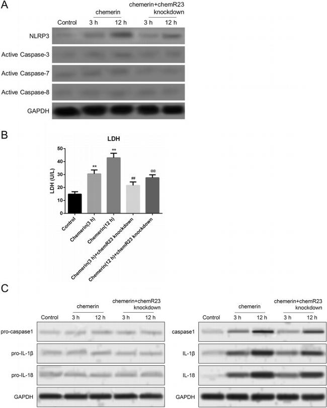 IL-1 beta Antibody in Western Blot (WB)