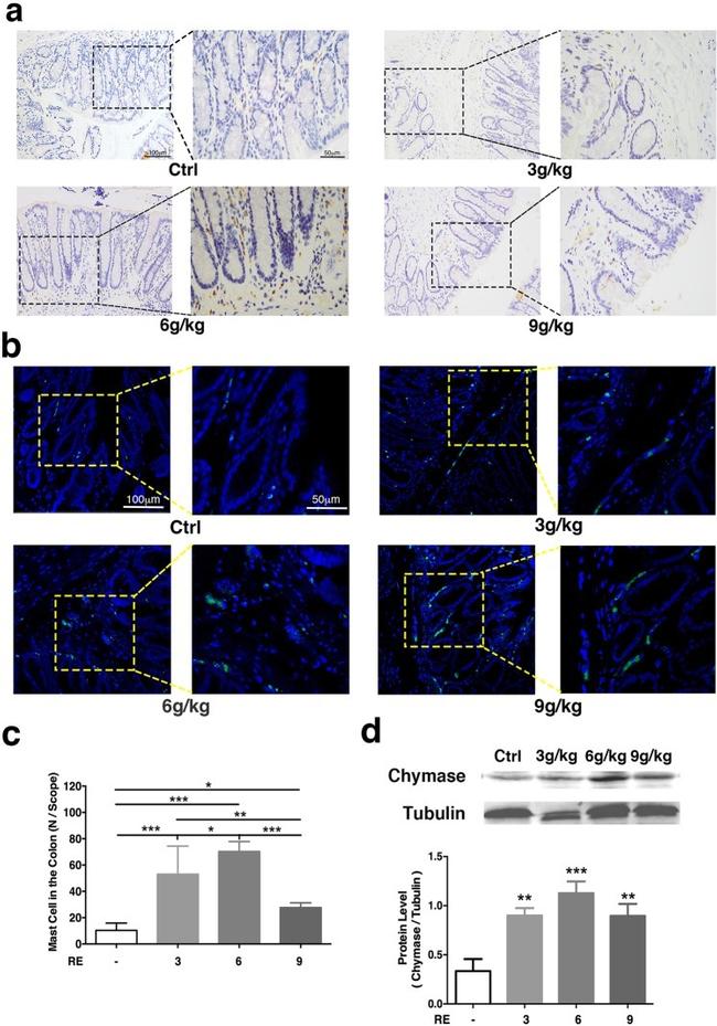 c-Kit Antibody in Immunohistochemistry (IHC)