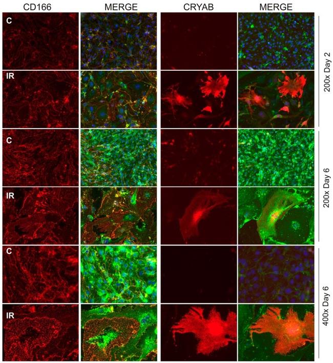 CD166 Antibody in Immunocytochemistry (ICC/IF)