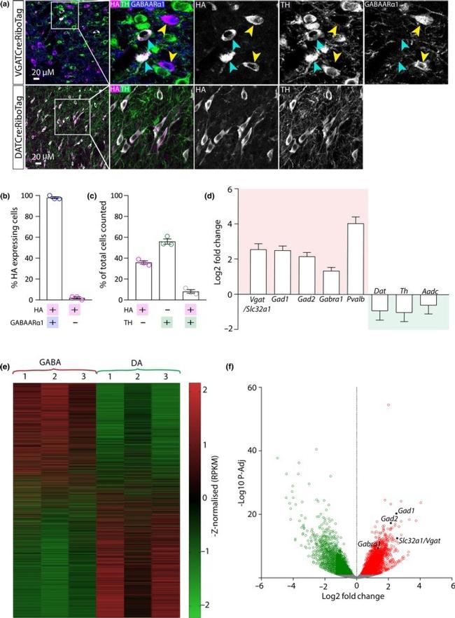 Cerebellin 4 Antibody in Immunohistochemistry (IHC)