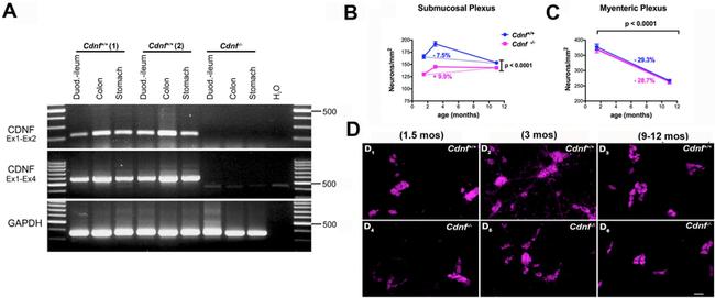 HuC/HuD Antibody in Immunocytochemistry (ICC/IF)