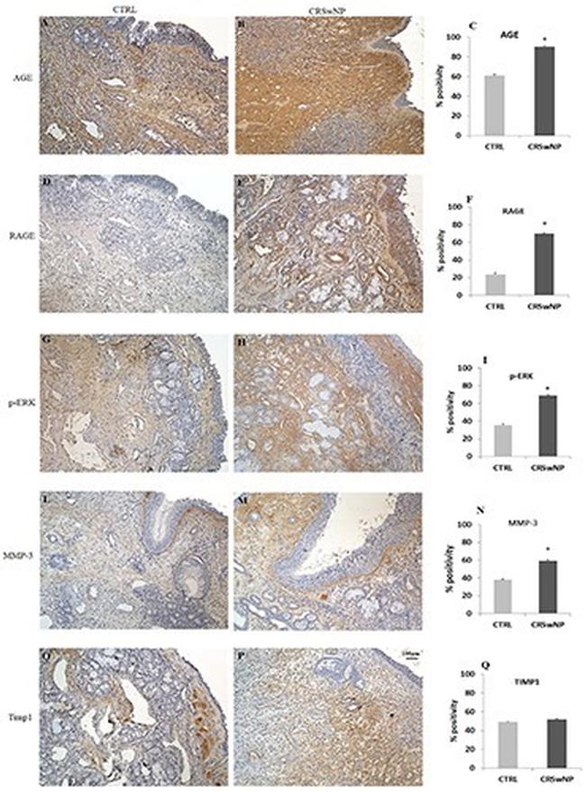 RAGE Antibody in Immunohistochemistry (IHC)