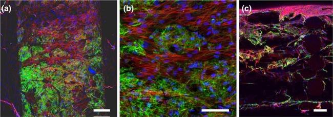 Fibronectin Antibody in Immunocytochemistry (ICC/IF)