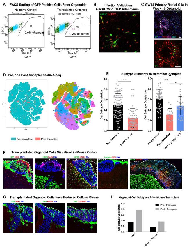 PGK1 Antibody in Immunohistochemistry (IHC)