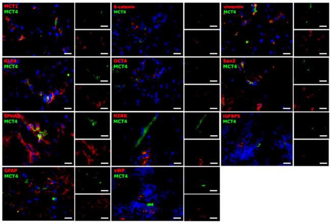 KLF4 Antibody in Immunocytochemistry (ICC/IF)