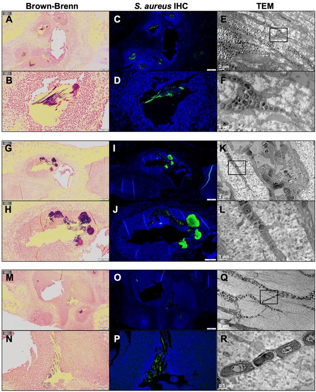 Staphylococcus aureus Antibody in Immunohistochemistry (IHC)