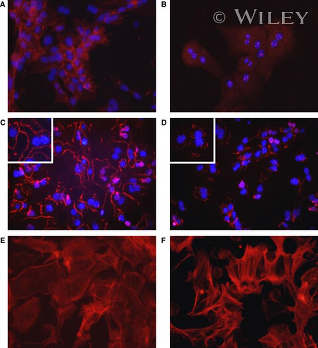 ZO-1 Antibody in Immunohistochemistry (IHC)