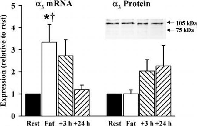 ATP1A3 Antibody in Western Blot (WB)