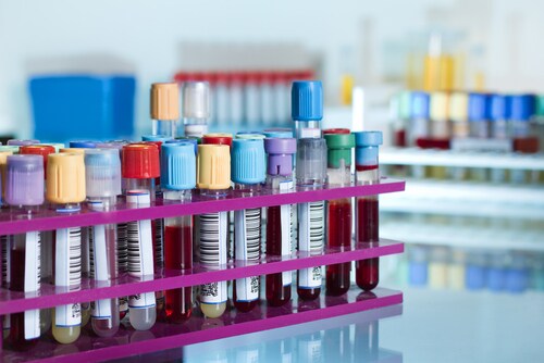 Rack of test tubes with blood samples. Image: angellodeco/Shutterstock.com