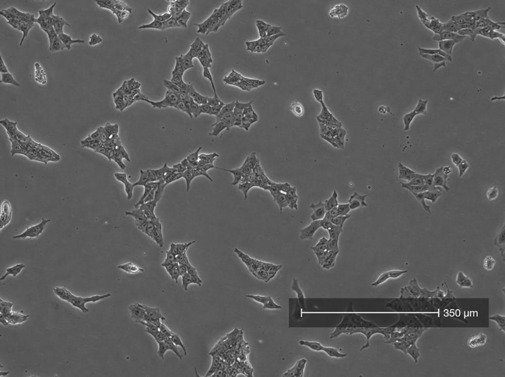 iPSC cell confluency view