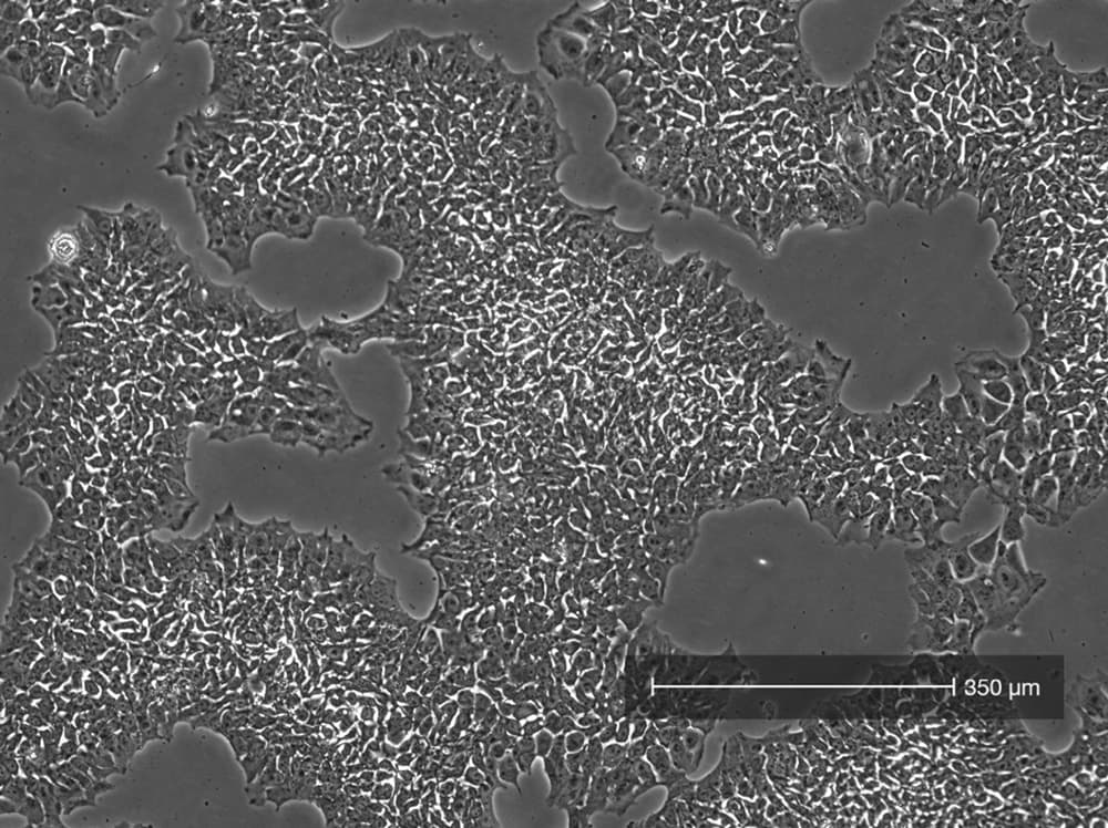 Cell confluency view 