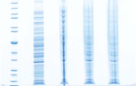 troubleshooting western blot no bands