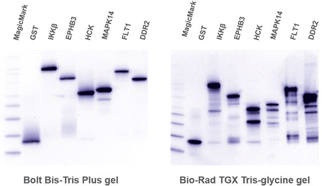Bis-Tris Gels: Sharpen Up Your Protein Bands